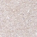 Merck Anti-PABPC1L2A antibody produced in rabbit