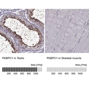 Merck Anti-PABPC1 antibody produced in rabbit