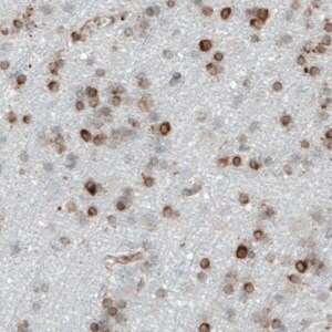 Merck Monoclonal Anti-MTDH antibody produced in mouse