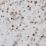 Merck Monoclonal Anti-MTDH antibody produced in mouse