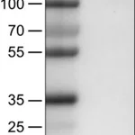 Merck Monoclonal Anti-KIT antibody produced in mouse