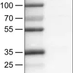 Merck Monoclonal Anti-KDM5B antibody produced in mouse