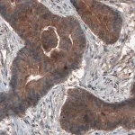Merck Monoclonal Anti-ST13 antibody produced in mouse