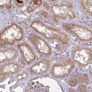 Merck Anti-IL1R1 antibody produced in rabbit