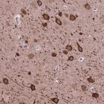 Merck Anti-PIAS3 antibody produced in rabbit