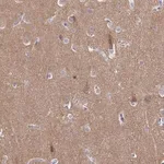 Merck Anti-CDH18 antibody produced in rabbit