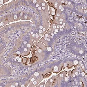 Merck Anti-IL1R1 antibody produced in rabbit