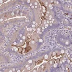 Merck Anti-IL1R1 antibody produced in rabbit