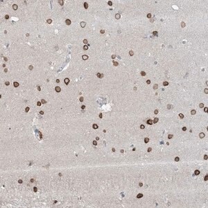 Merck Anti-FNDC1 antibody produced in rabbit