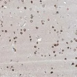 Merck Anti-FNDC1 antibody produced in rabbit