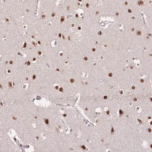 Merck Anti-RFK antibody produced in rabbit