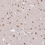 Merck Anti-RFK antibody produced in rabbit