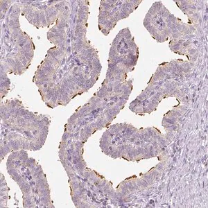 Merck Anti-LCA5 antibody produced in rabbit