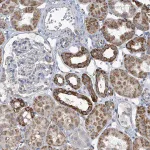 Merck Anti-OGT antibody produced in rabbit