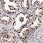 Merck Anti-C3orf38 antibody produced in rabbit