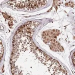 Merck Anti-DMXL1 antibody produced in rabbit