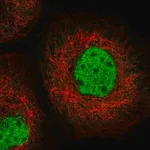Merck Anti-SFMBT1 antibody produced in rabbit