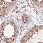 Merck Anti-STT3B antibody produced in rabbit