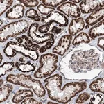 Merck Anti-TSSK3 antibody produced in rabbit