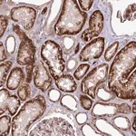 Merck Anti-PSTK antibody produced in rabbit
