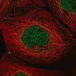 Merck Anti-PPP1R2 antibody produced in rabbit