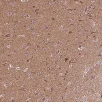 Merck Anti-MAPK11 antibody produced in rabbit