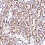 Merck Anti-AP3M1 antibody produced in rabbit