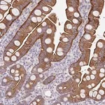 Merck Anti-PTPN3 antibody produced in rabbit