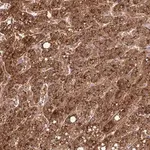 Merck Anti-TONSL antibody produced in rabbit