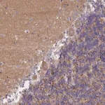 Merck Anti-AP3M1 antibody produced in rabbit