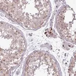 Merck Anti-NOTCH2 antibody produced in rabbit