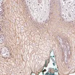 Merck Anti-TP53AIP1 antibody produced in rabbit
