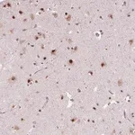 Merck Anti-DDX41 antibody produced in rabbit