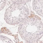 Merck Anti-CFHR2 antibody produced in rabbit