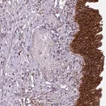 Merck Anti-TUSC3 antibody produced in rabbit