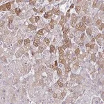 Merck Anti-LDLRAP1 antibody produced in rabbit