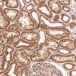 Merck Anti-TNIP2 antibody produced in rabbit