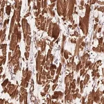 Merck Anti-CCDC112 antibody produced in rabbit