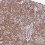 Merck Anti-IKBKAP antibody produced in rabbit