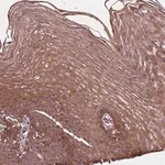 Merck Anti-B3GALNT2 antibody produced in rabbit