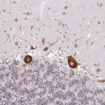 Merck Anti-LARP1 antibody produced in rabbit