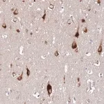 Merck Anti-ATP13A2 antibody produced in rabbit