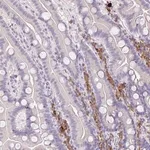 Merck Anti-ZNF215 antibody produced in rabbit