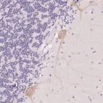 Merck Anti-PNLIPRP3 antibody produced in rabbit