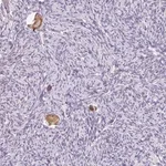 Merck Anti-SNX31 antibody produced in rabbit