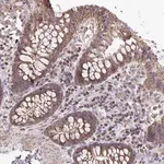 Merck Anti-ATP13A2 antibody produced in rabbit