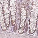Merck Anti-BLOC1S2 antibody produced in rabbit