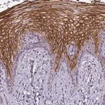 Merck Anti-NUDT3 antibody produced in rabbit