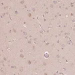 Merck Anti-CDIPT antibody produced in rabbit