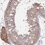 Merck Anti-ZFYVE28 antibody produced in rabbit